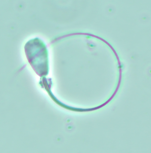 proximal cytoplasmic droplet