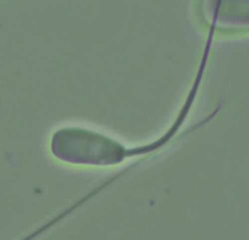 Small Vacuole